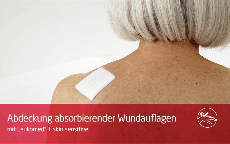 In diesem Video demonstrieren wir den Einsatz des transparenten Wundverbands auf fragiler Haut. Das Fachpersonal platziert Leukomed® T skin sensitive auf der Schulter einer älteren Patientin. In diesem Video demonstrieren wir den Einsatz des transparenten Wundverbands auf fragiler Haut. Das Fachpersonal platziert Leukomed® T skin sensitive auf der Schulter einer älteren Patientin.